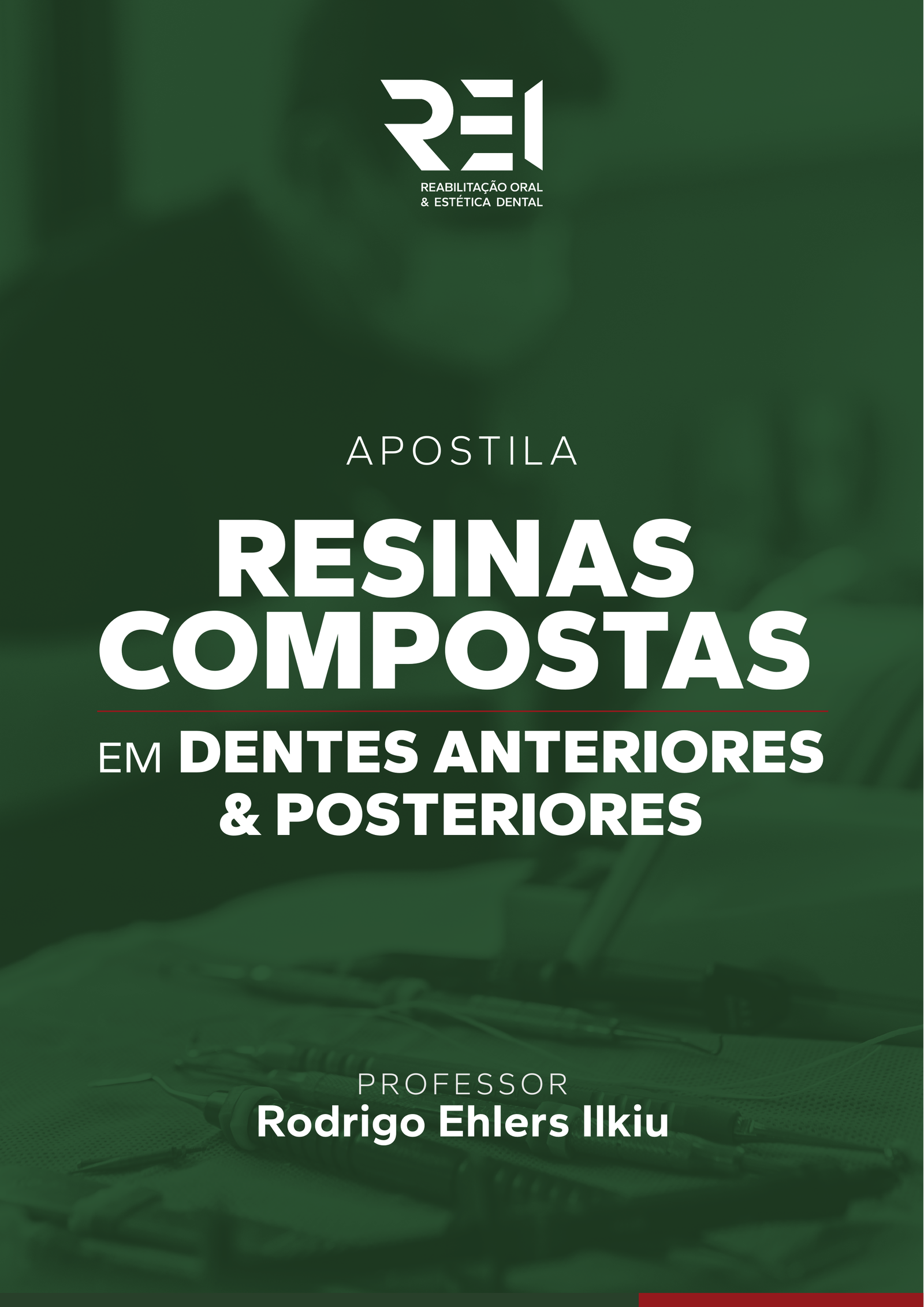 Resinas Compostas em Dentes Anteriores e Posteriores