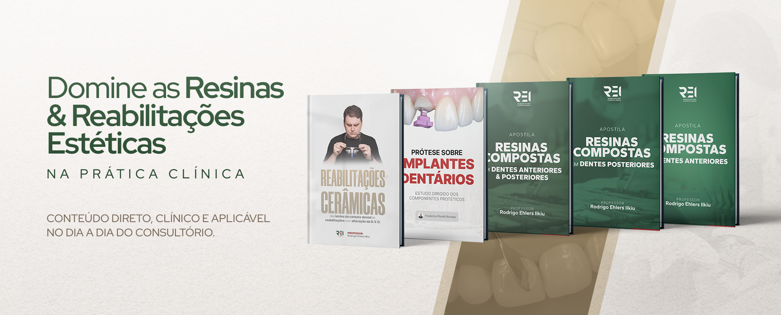Coleção REI de Apostilas de Odontologia Estética