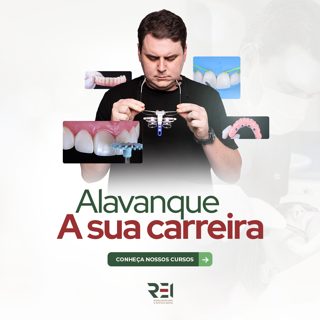 Alavanque sua Carreira
