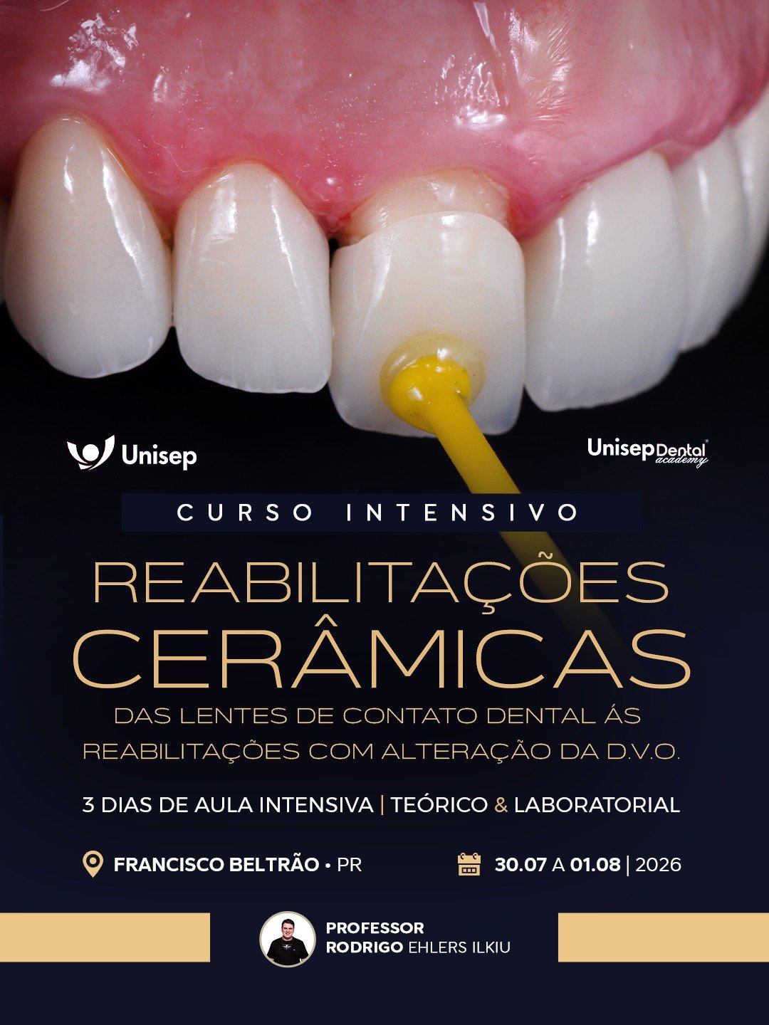 Imersão em Reabilitações Cerâmicas Francisco Beltrão