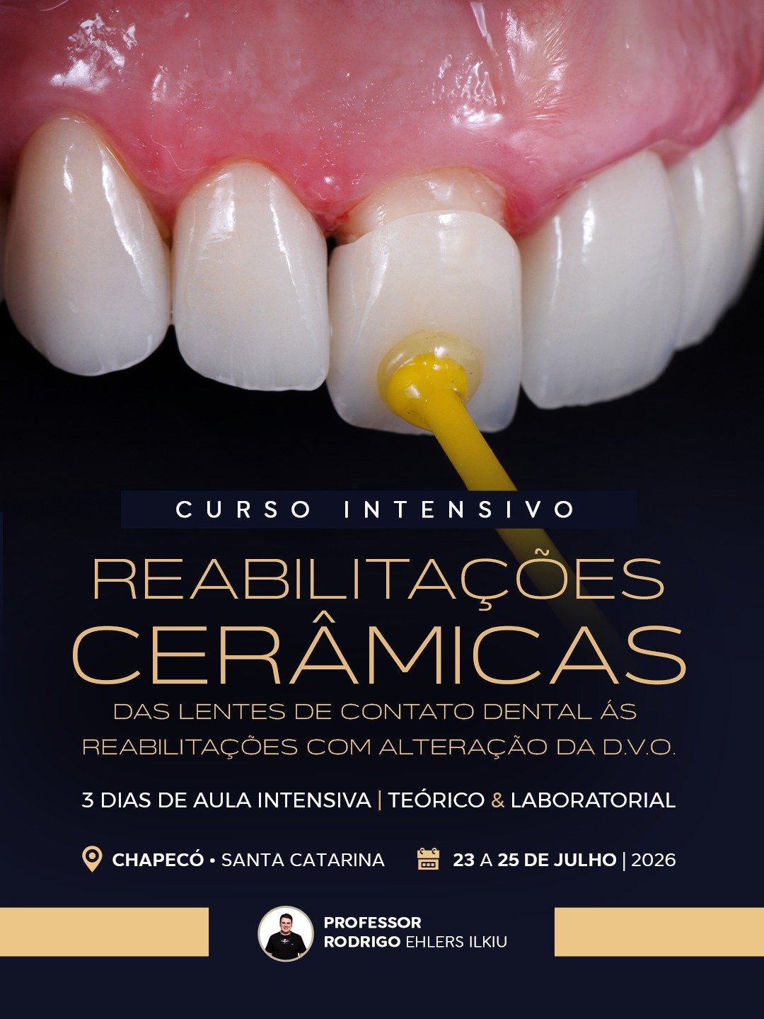 Imersão em Reabilitações Cerâmicas Chapecó