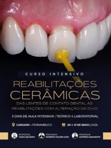 Imersão – Reabilitações Cerâmicas – Caruaru (29-31 Maio)