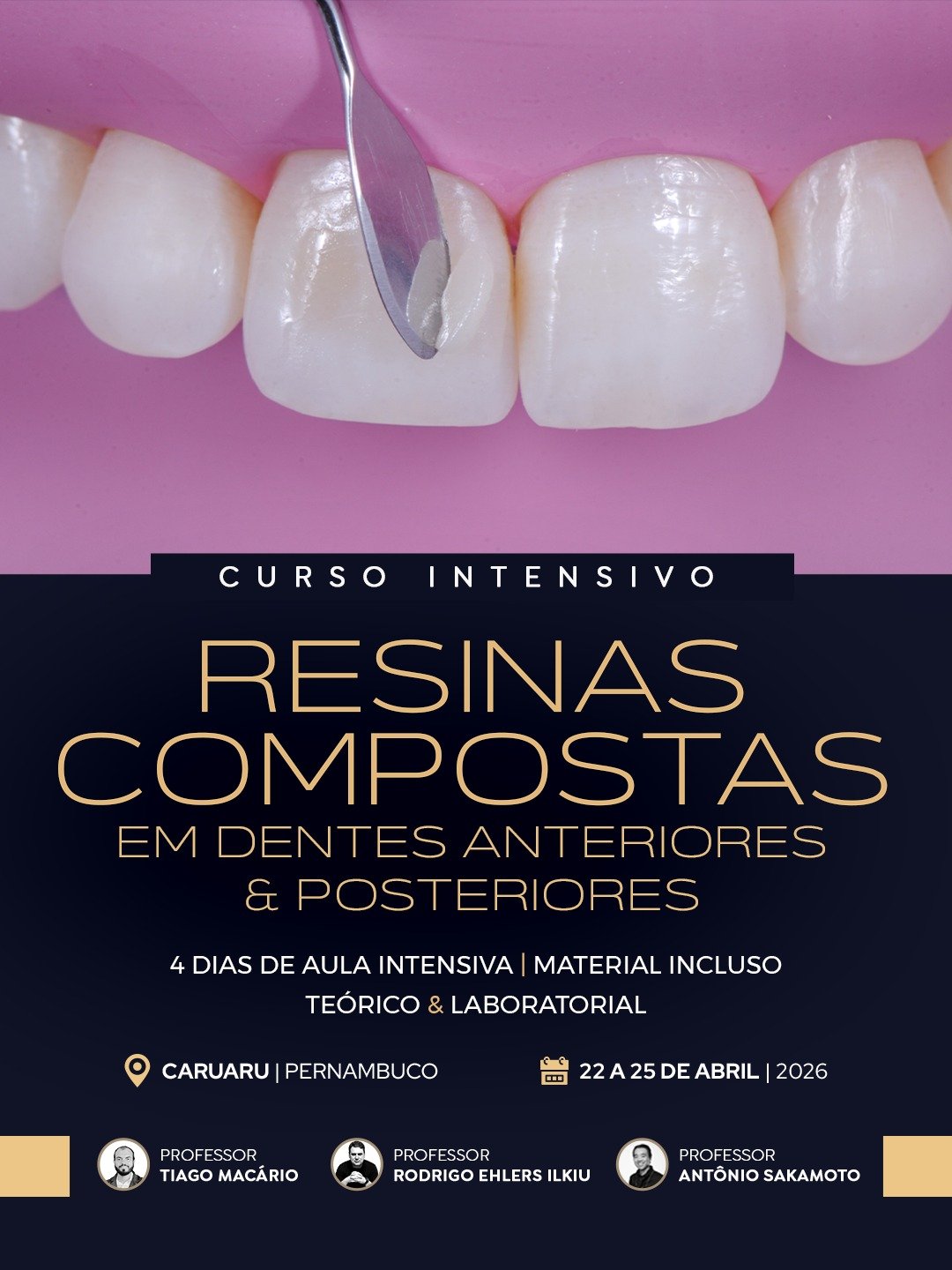 Imersão em Resinas Compostas Caruaru