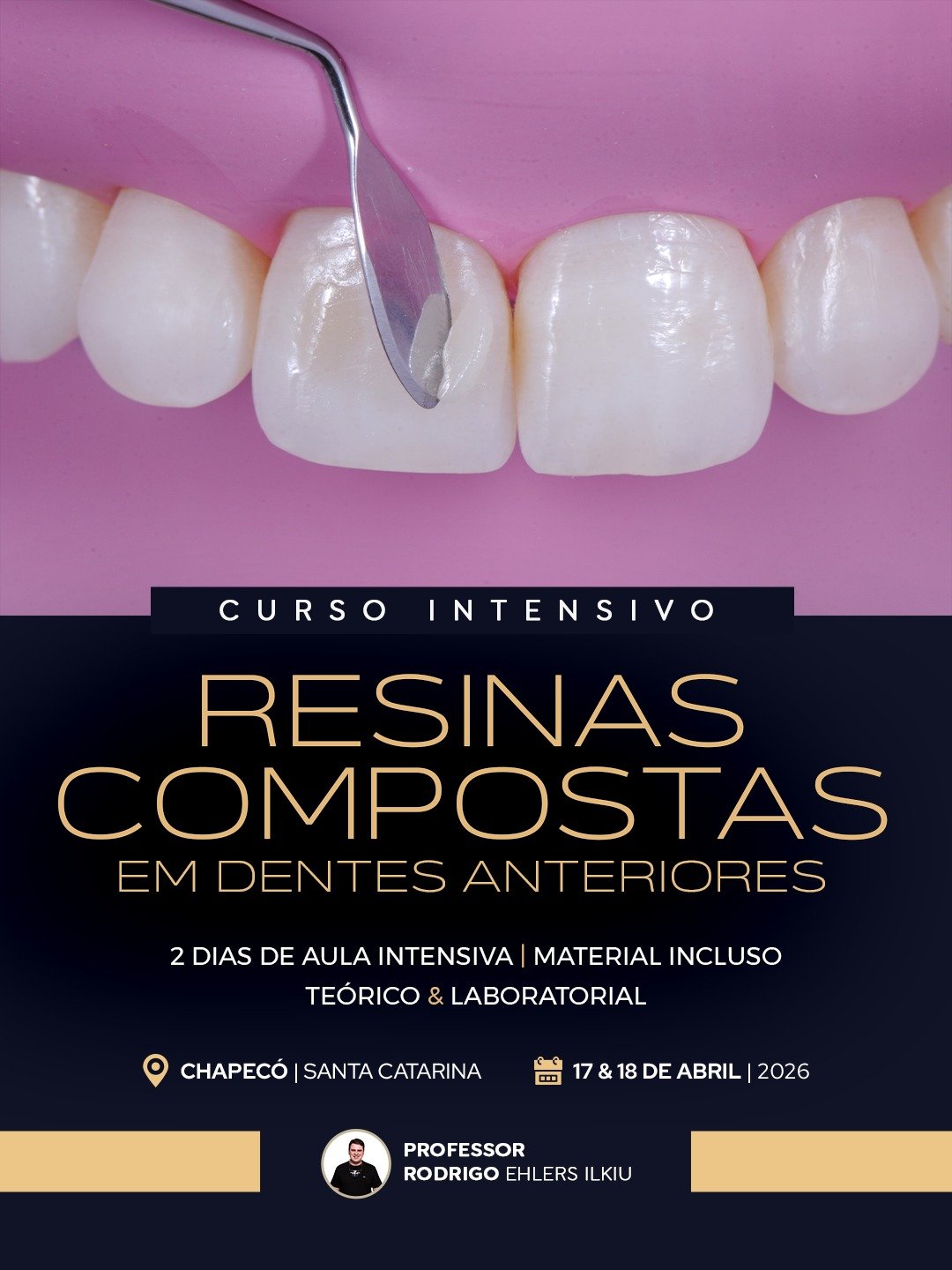 Imersão em Resinas Compostas Chapecó