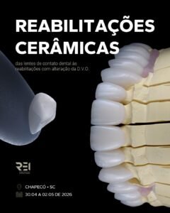 Imersão – Reabilitações Cerâmicas – Chapecó (30-02 Maio)