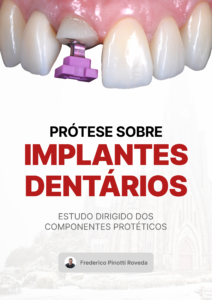 Apostila – Prótese Sobre Implante