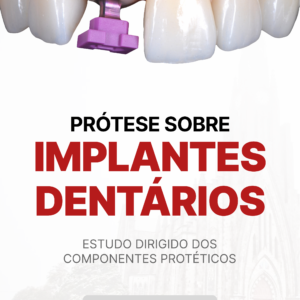 Apostila - Prótese Sobre Implante