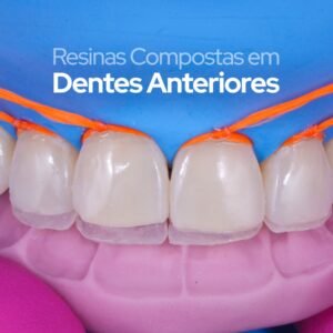 Imersão - Resinas Compostas em Dentes Anteriores - Pato Branco (14-15 Novembro)